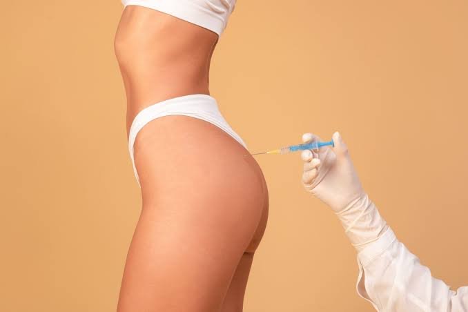 Procedimento de harmonização glútea